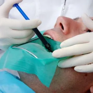 Root Canal Treatment